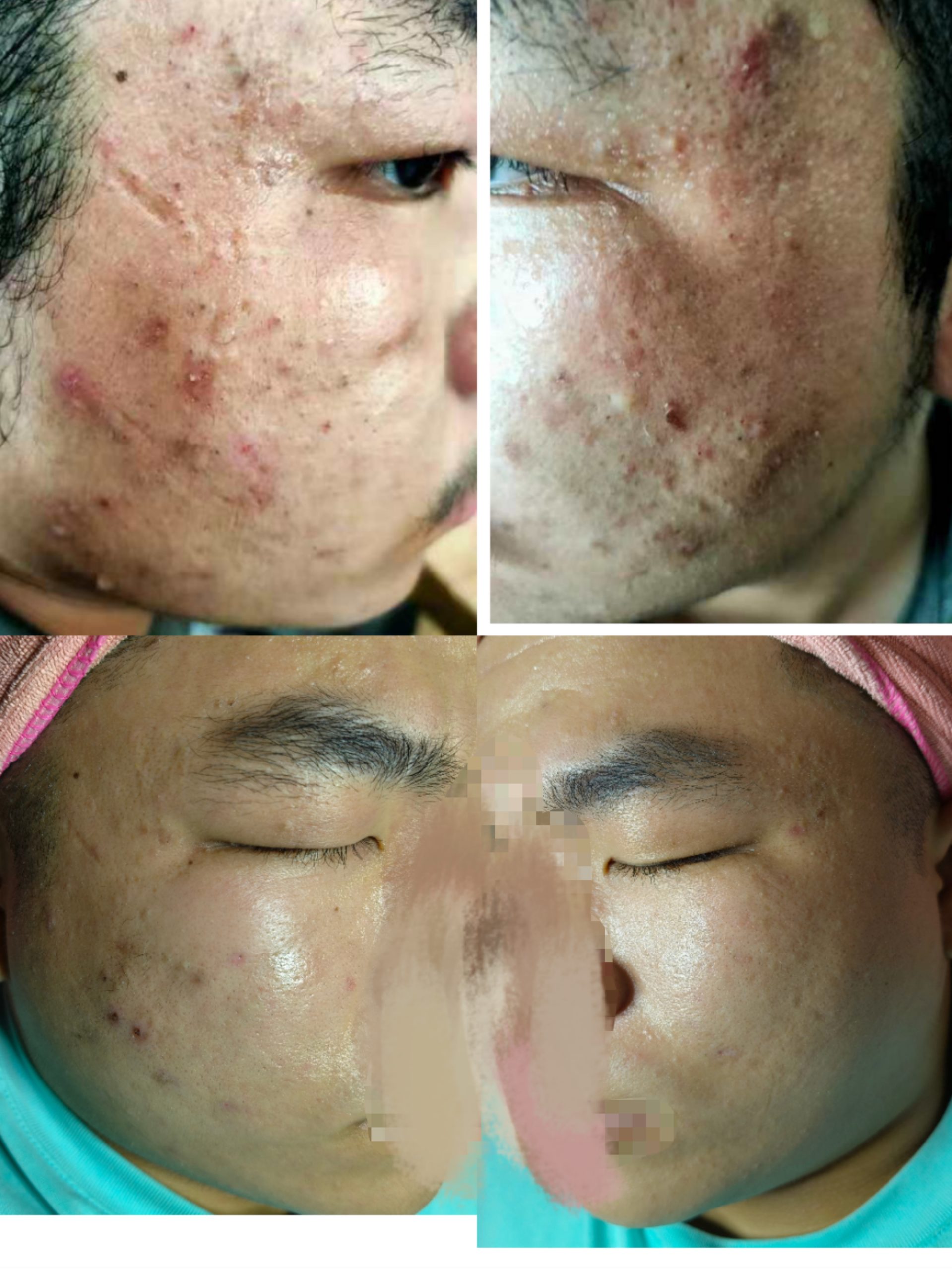 2025021317245624